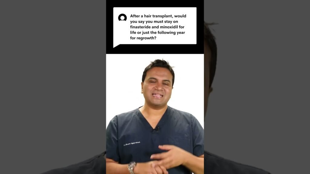 Drawbacks of choosing Minoxidil vs hair transplant