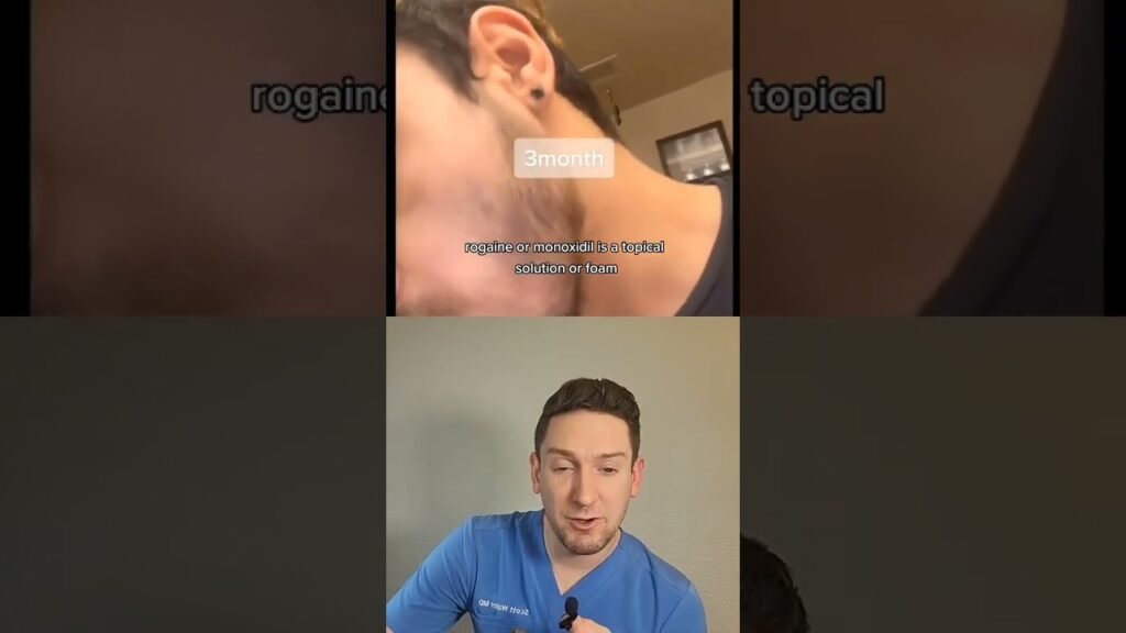 How long does Thicker beard with minoxidil