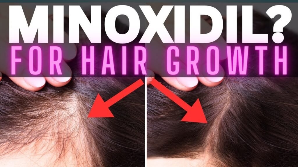 Pros and cons of Minoxidil vs hair growth serum