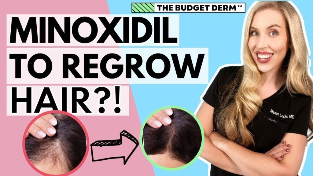 Side-by-side review of Best brand of minoxidil