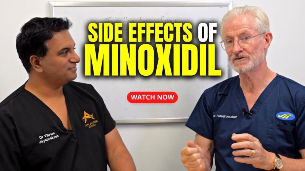 Side effects of Minoxidil results