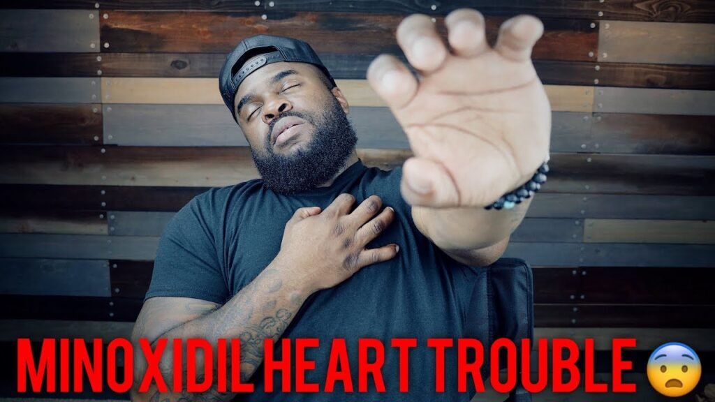 Side effects of using Minoxidil and heart rate
