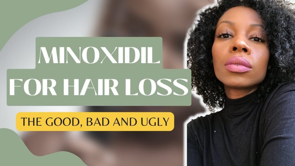 Ultimate guide to Minoxidil for women