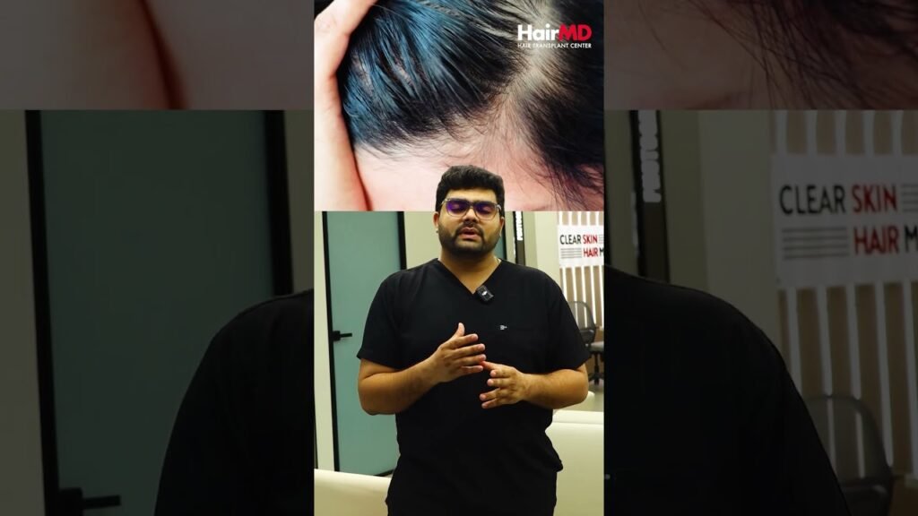 Ultimate guide to Minoxidil results