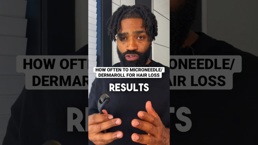 What to do if Can minoxidil be used with derma roller?
