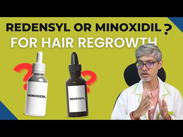 What works best: Minoxidil vs redensyl