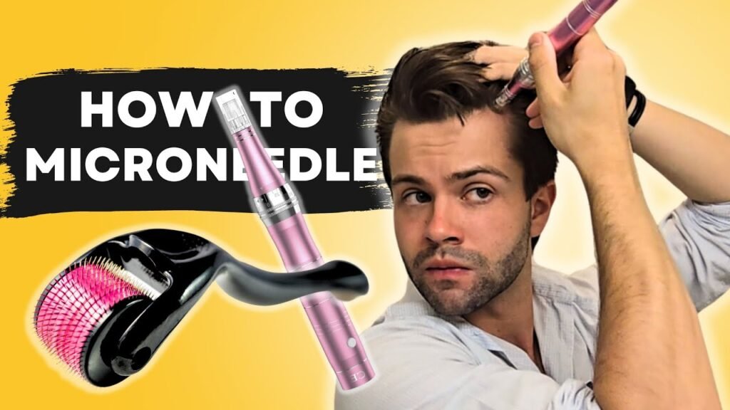 Which is better: Minoxidil vs derma roller
