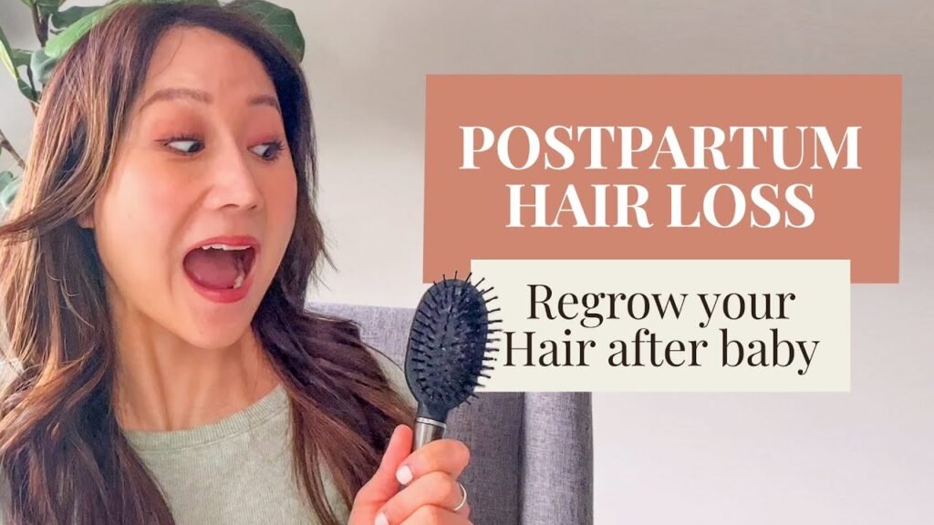 Why choose Minoxidil for postpartum hair loss