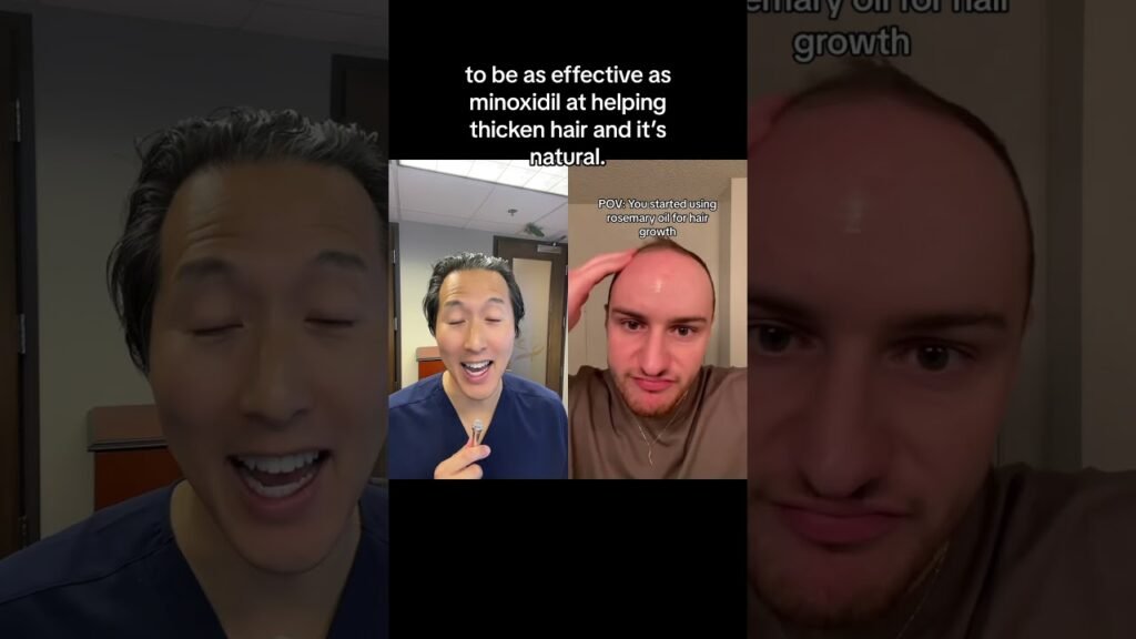 Comparing results from Minoxidil vs rosemary oil