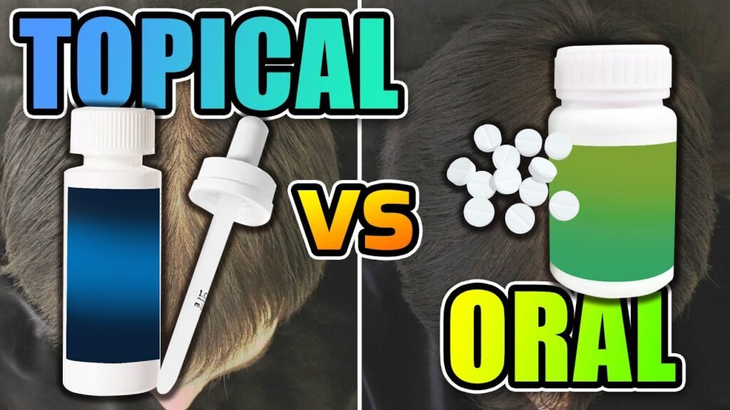 Side-by-side review of Oral minoxidil vs topical