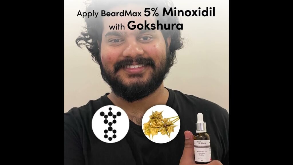 Side effects of Minoxidil beard results