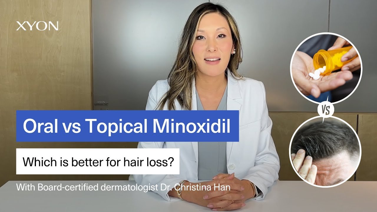 What’s the difference between Oral minoxidil vs topical