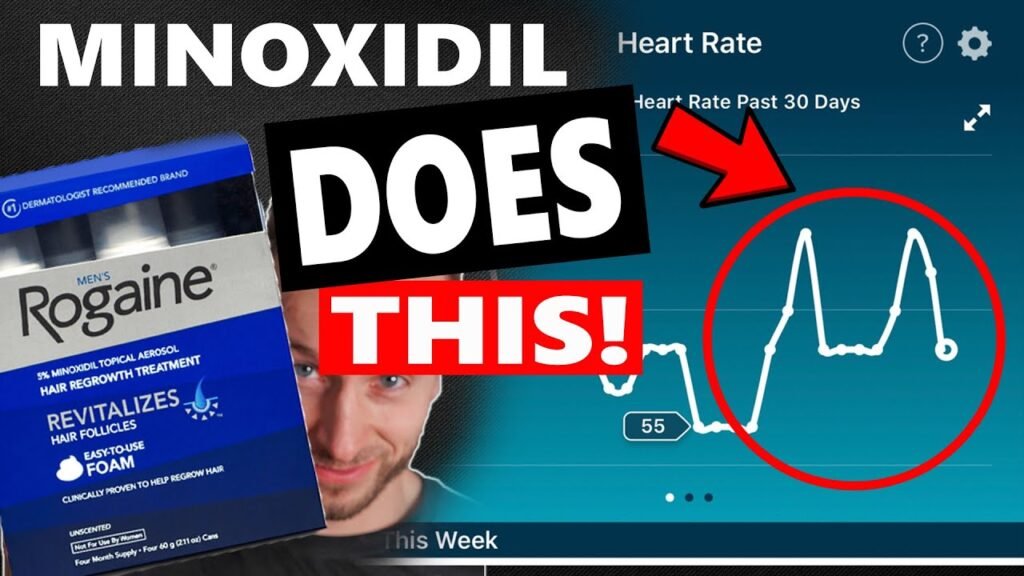 Risks associated with Minoxidil and heart rate