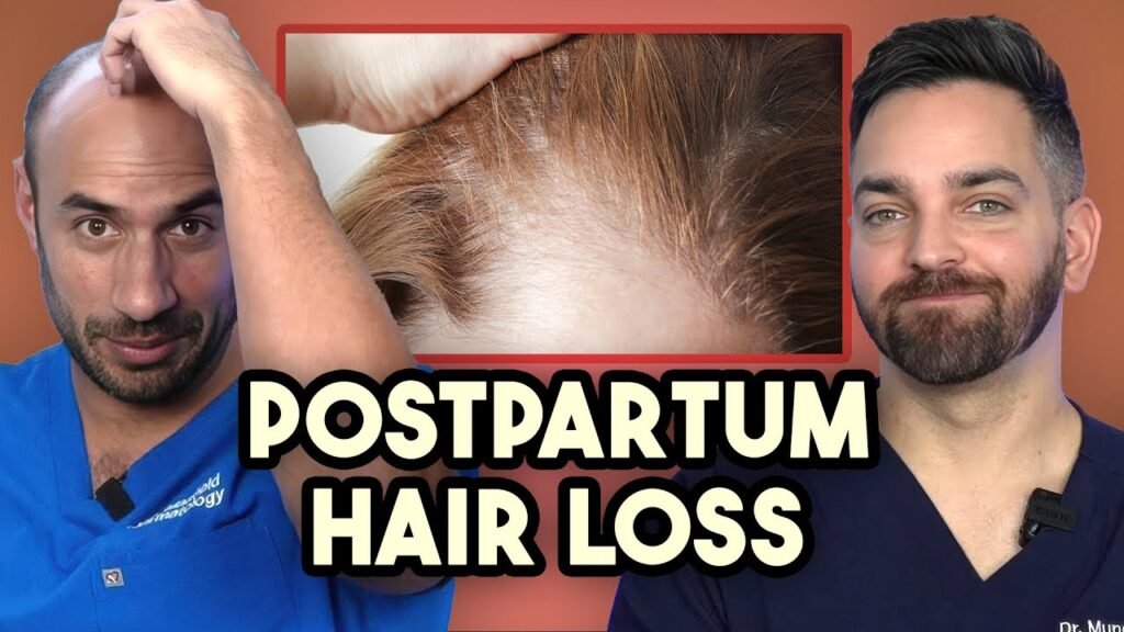 Minoxidil solutions for Minoxidil for postpartum hair loss