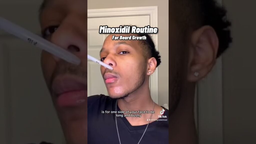 Step-by-step guide to Minoxidil patchy beard