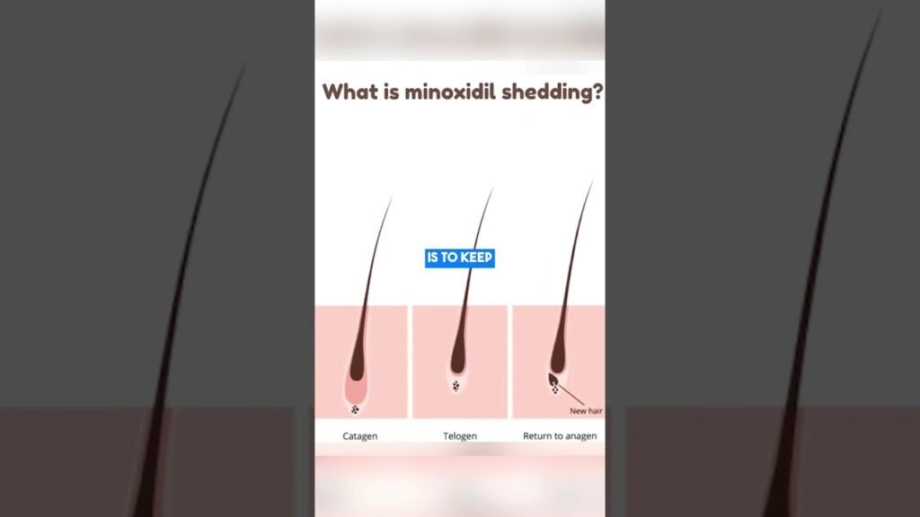 Can Minoxidil for men