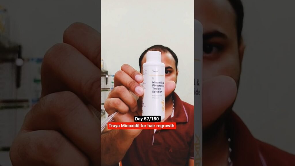 Honest review of Minoxidil testimonials