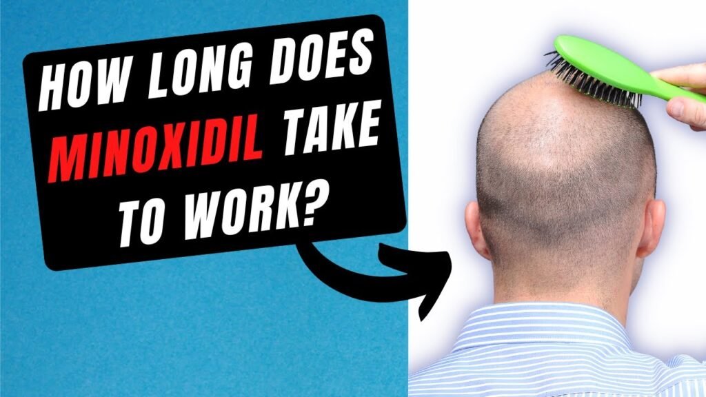 How to use How long does minoxidil take