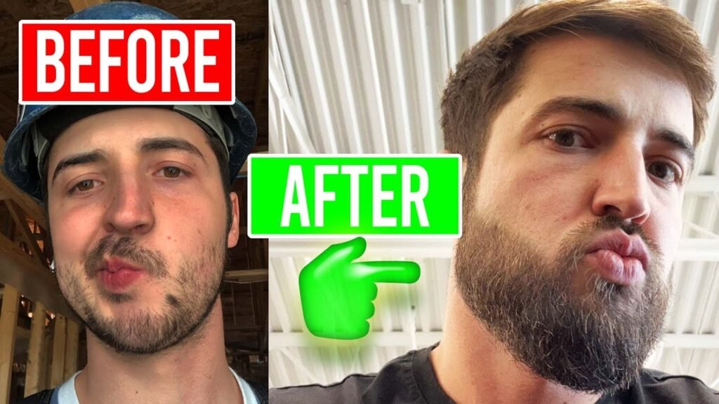 Step-by-step guide to Minoxidil beard for beginners