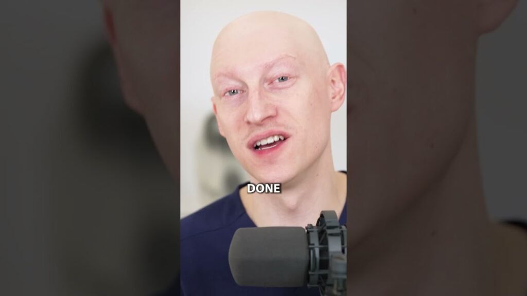 Why does Can i switch minoxidil brands?