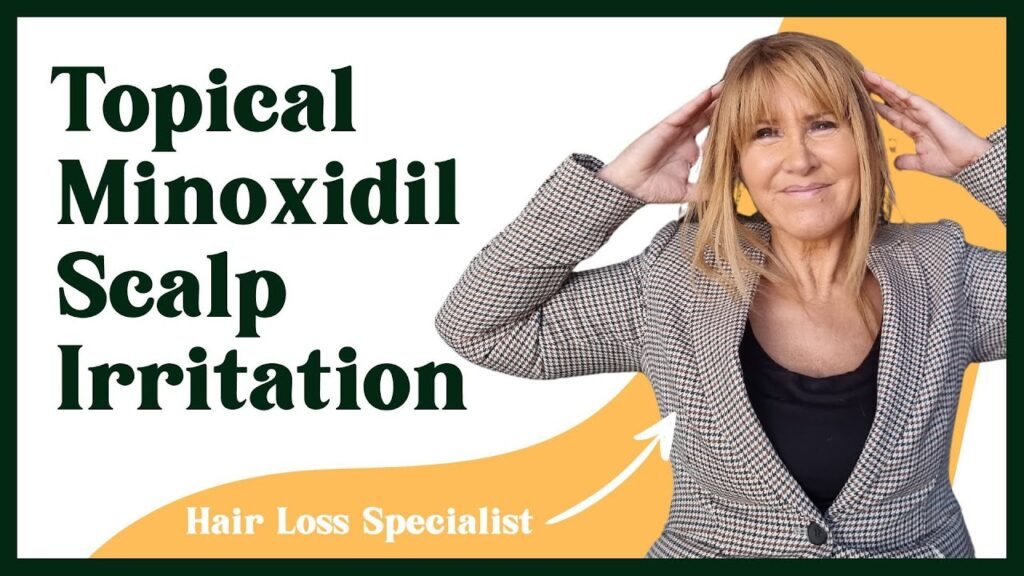 How to treat Scalp redness from minoxidil