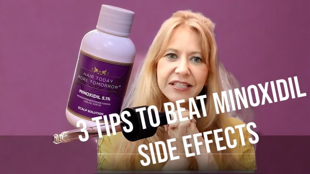 Top tips for Minoxidil side effects in women