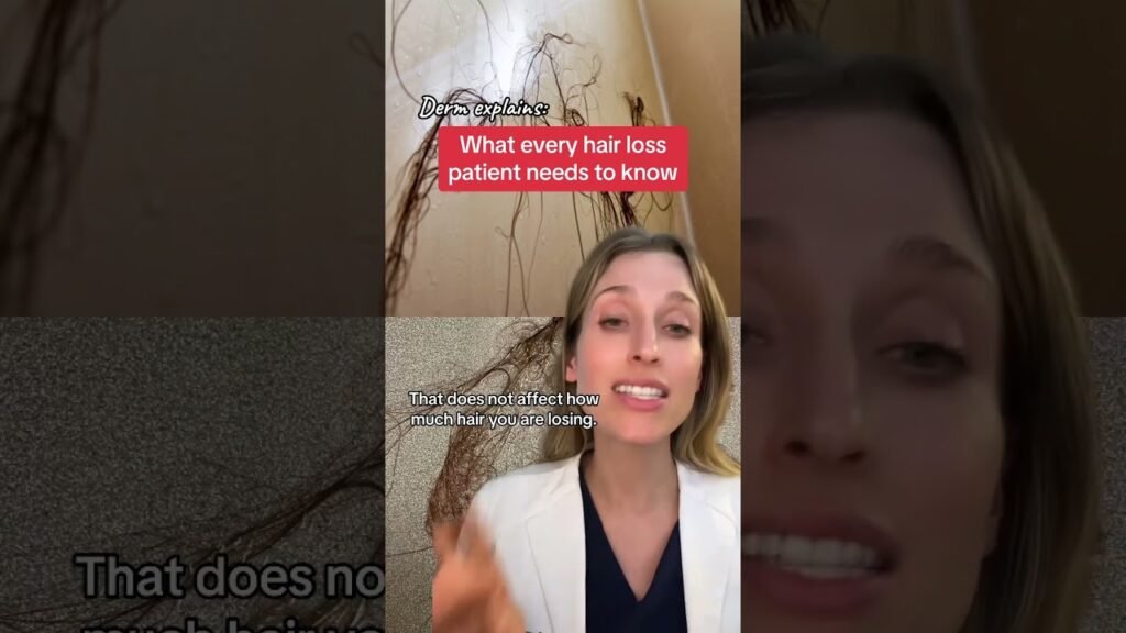 Top signs of Minoxidil shedding phase