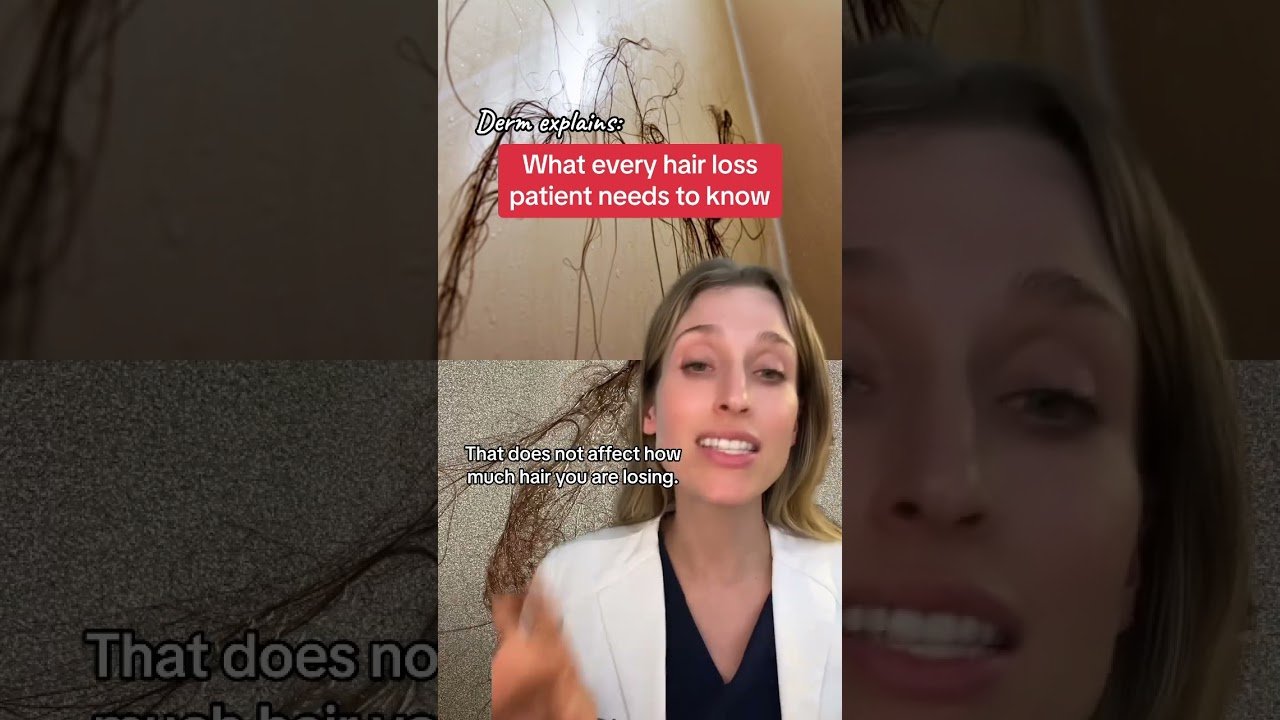 Top signs of Minoxidil shedding phase