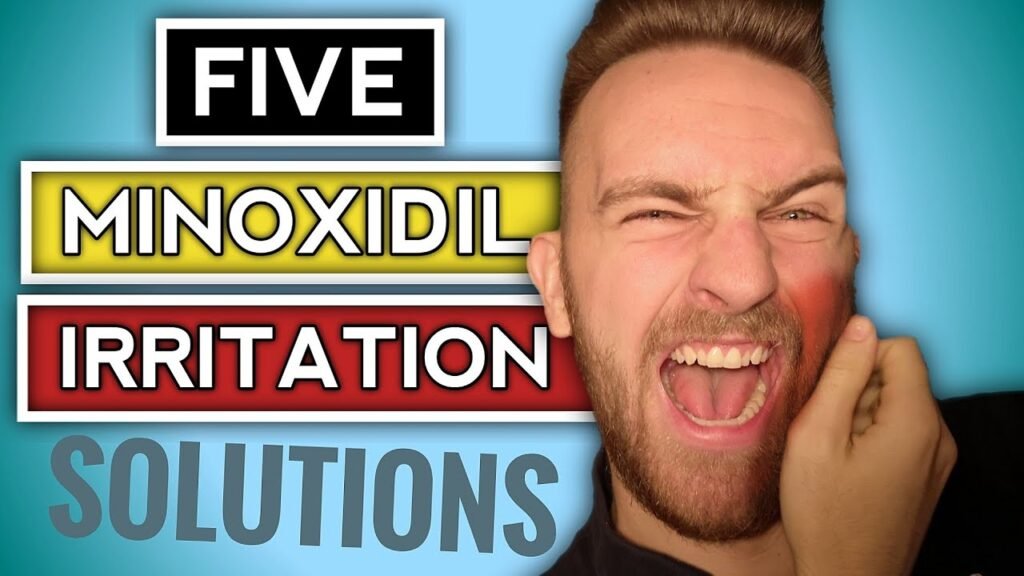 What causes Minoxidil and dry skin