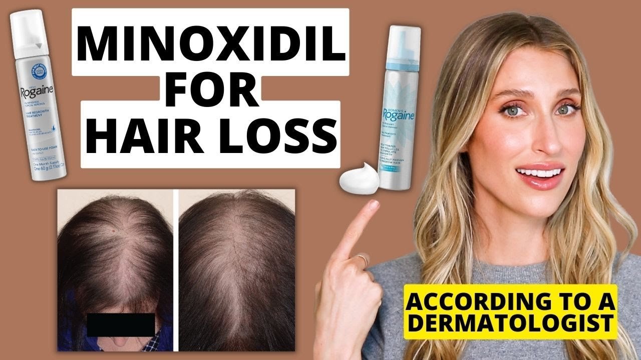 What women should know about Minoxidil and women's scalp health